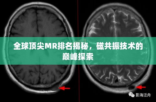 全球頂尖MR排名揭秘，磁共振技術(shù)的巔峰探索