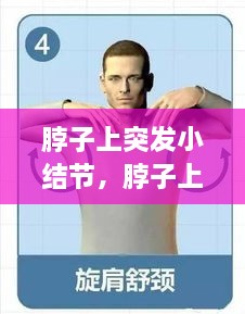脖子上突發(fā)小結(jié)節(jié)，脖子上的小結(jié)節(jié)要緊嗎 